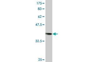 Western Blot detection against Immunogen (36. (RAD18 抗体  (AA 332-430))