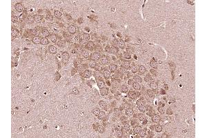 Paraformaldehyde-fixed, paraffin embedded Mouse brain Antigen retrieval by boiling in sodium citrate buffer (pH6. (IL6RA 抗体  (AA 351-460))