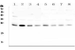 Western blot analysis of RAB11B using anti-RAB11B antibody (ABIN6719364).