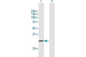 Western Blotting (WB) image for anti-Solute Carrier Family 14 (Urea Transporter), Member 1 (Kidd Blood Group) (SLC14A1) (AA 1-389) antibody (ABIN520256)