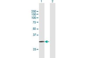 Western Blot analysis of SLC14A1 expression in transfected 293T cell line by SLC14A1 MaxPab polyclonal antibody. (SLC14A1 抗体  (AA 1-389))