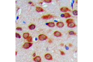 Immunohistochemistry (IHC) image for anti-Cytochrome C Oxidase Subunit IV Isoform 1 (COX4I1) (N-Term) antibody (ABIN7300548)
