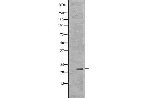 Western Blotting (WB) image for anti-Inhibitor of DNA Binding 1, Dominant Negative Helix-Loop-Helix Protein (ID1) (Internal Region) antibody (ABIN6262441)