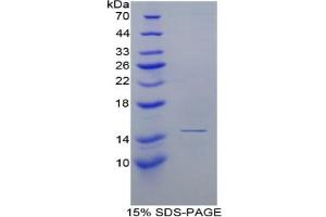 SDS-PAGE of Protein Standard from the Kit (Highly purified E. (Complement Factor B ELISA 试剂盒)