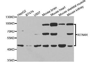 Western blot analysis of extracts of various cell lines, using RTN4R antibody. (RTN4R 抗体)