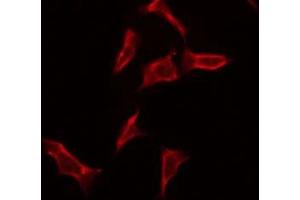 ABIN6275706 staining Hela by IF/ICC. (ZP4 抗体  (Internal Region))