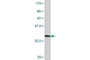 Western Blot detection against Immunogen (37 KDa) . (AMY2B 抗体  (AA 19-117))