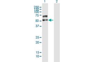 Western Blot analysis of PLD4 expression in transfected 293T cell line by PLD4 MaxPab polyclonal antibody. (Phospholipase D4 抗体  (AA 1-489))
