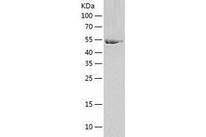 SEPSECS Protein (AA 1-501) (His tag)