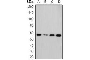 Western blot analysis of NEK3 expression in HepG2 (A), Hela (B), mouse kidney (C), rat brain (D) whole cell lysates. (NEK3 抗体)