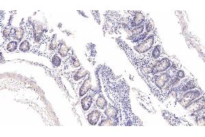 Detection of FXR in Rat Colon Tissue using Polyclonal Antibody to Farnesoid X Receptor (FXR) (NR1H4 抗体  (AA 375-568))