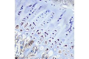 Immunohistochemistry of paraffin-embedded mouse bone marrow using Aggrecan Rabbit mAb (ABIN7265514) at dilution of 1:100 (40x lens). (Aggrecan 抗体)