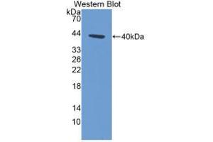 Western blot analysis of recombinant Human KRT14. (KRT14 抗体  (AA 111-418))