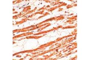 Immunohistochemical staining of human cardiac muscle stained with TNNT2 polyclonal antibody  at 1 : 50 for 10 min at RT. (Cardiac Troponin T2 抗体)