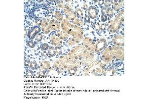 Human kidney (RASSF7 抗体  (Middle Region))