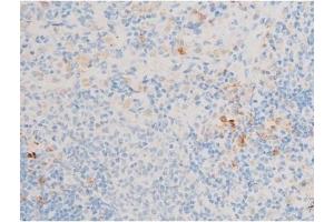ABIN6256094 and ABIN6267526 at 1/200 staining Rat spleen tissue sections by IHC-P.