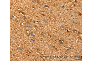 Immunohistochemistry of Human brain using SLC25A4 Polyclonal Antibody at dilution of 1:30 (SLC25A4 抗体)