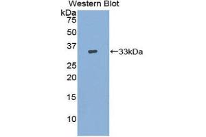 Western Blotting (WB) image for anti-Adenylate Cyclase 9 (ADCY9) (AA 1029-1282) antibody (ABIN1857914) (ADCY9 抗体  (AA 1029-1282))