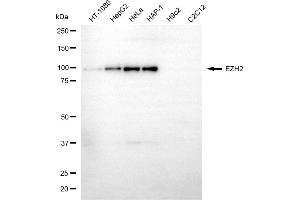 Western blotting analysis using EZH2 antibody (ABIN7798446).