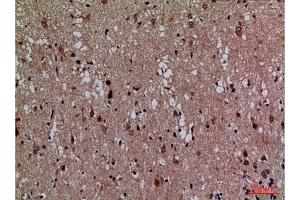 Immunohistochemical analysis of paraffin-embedded human brain, antibody was diluted at 1:100. (CDK4 抗体  (N-Term))