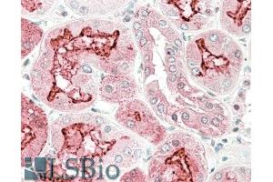 ABIN5539546 (5µg/ml) staining of paraffin embedded Human Kidney.