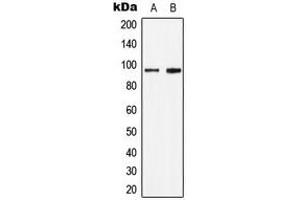 Western blot analysis of STAT6 (pY641) expression in HepG2 IL4-treated (A), HeLa IL-4-treated (B) whole cell lysates.