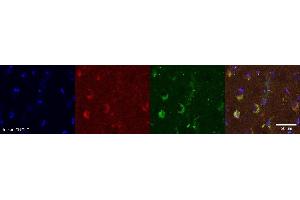Immunohistochemistry (IHC) image for anti-PDZ and LIM Domain 5 (PDLIM5) antibody (ABIN7456030) (PDLIM5 抗体)