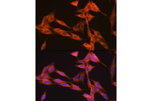 Immunofluorescence analysis of NIH-3T3 cells using PIK3C3/VPS34 Rabbit mAb (ABIN7269328) at dilution of 1:100 (40x lens). (PIK3C3 抗体)