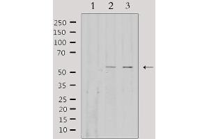 Western blot analysis of extracts from various samples, using EFEMP1 Antibody. (FBLN3 抗体  (Internal Region))
