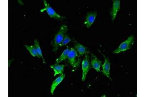 Immunofluorescent analysis of Hela cells using ABIN7171581 at dilution of 1:100 and Alexa Fluor 488-congugated AffiniPure Goat Anti-Rabbit IgG(H+L) (TBP 抗体  (AA 1-55))