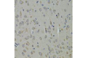 Immunohistochemistry of paraffin-embedded mouse brain using RPL9 Antibody. (RPL9 抗体  (AA 1-192))