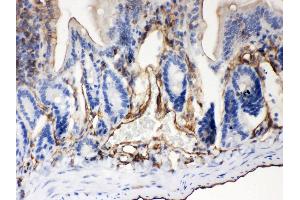 Anti- ABCB4 Picoband antibody, IHC(P) IHC(P): Mouse Intestine Tissue (ABCB4 抗体  (AA 601-720))