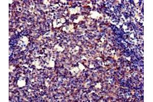 Immunohistochemistry of paraffin-embedded human tonsil tissue using ABIN7150247 at dilution of 1:100 (POLH 抗体  (AA 408-609))