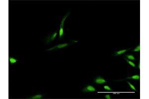Immunofluorescence of purified MaxPab antibody to TIMELESS on HeLa cell.