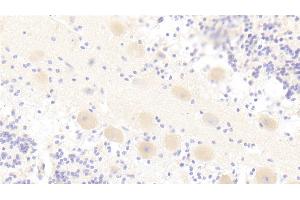 Immunohistochemistry (IHC) image for anti-Toll-Interleukin 1 Receptor (TIR) Domain Containing Adaptor Protein (TIRAP) (AA 1-221) antibody (ABIN7441712)