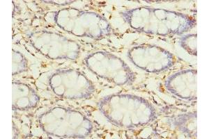 Immunohistochemistry of paraffin-embedded human colon tissue using ABIN7164641 at dilution of 1:100