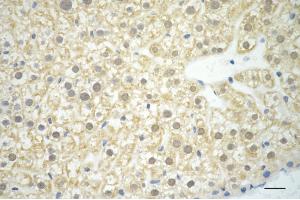Immunohistochemistry was performed on paraffin-embedded mouse liver using MAP2K3 antibody (ABIN7799465), 1:200).