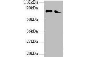 Western blot All lanes: ERP29 antibody at 2 μg/mL Lane 1: EC109 whole cell lysate Lane 2: 293T whole cell lysate Secondary Goat polyclonal to rabbit IgG at 1/15000 dilution Predicted band size: 29, 6 kDa Observed band size: 80 kDa (ERP29 抗体  (AA 40-251))