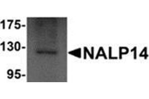 Western blot analysis of NALP14 in rat brain tissue lysate with NALP14 antibody at 1 μg/ml.