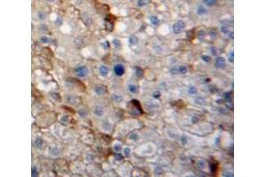 Used in DAB staining on fromalin fixed paraffin-embedded Liver tissue