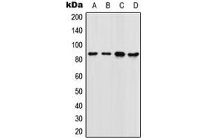 Western blot analysis of FOXM1 expression in SW480 (A), 22RV1 (B), NIH3T3 (C), rat colon (D) whole cell lysates. (FOXM1 抗体  (Center))
