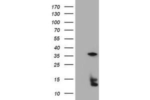 Image no. 5 for anti-Thymidylate Synthetase (TYMS) antibody (ABIN1501591) (TYMS 抗体)