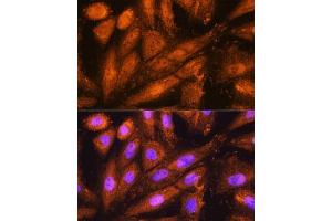 Immunofluorescence analysis of H9C2 cells using PSMD4 Rabbit pAb (ABIN3021329, ABIN3021330, ABIN3021331 and ABIN6214913) at dilution of 1:100. (PSMD4/ASF 抗体  (AA 1-377))