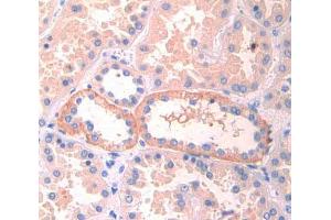 Used in DAB staining on fromalin fixed paraffin- embedded kidney tissue (LIFR 抗体  (AA 692-833))