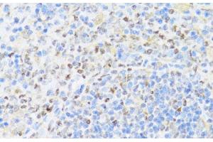 Immunohistochemistry of paraffin-embedded Rat spleen using UQCC2 Polyclonal Antibody at dilution of 1:100 (40x lens). (MNF1 抗体)