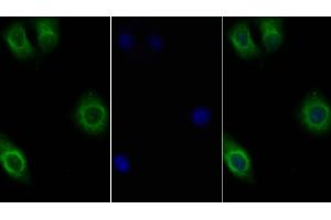 Detection of IL10Rb in Human Hela cell using Polyclonal Antibody to Interleukin 10 Receptor Beta (IL10Rb) (IL10RB 抗体  (AA 87-243))