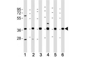Western blot testing of MICA antibody at 1:2000 dilution. (MICA 抗体  (AA 68-97))