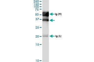 Immunoprecipitation (IP) image for anti-Sulfotransferase Family, Cytosolic, 2B, Member 1 (SULT2B1) (AA 1-365) antibody (ABIN948512)