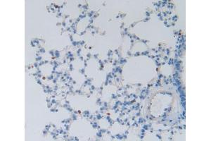 Used in DAB staining on fromalin fixed paraffin- embedded Kidney tissue