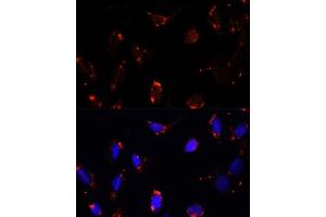 anti-Transforming Growth Factor beta Regulator 4 (TBRG4) (AA 382-631) antibody